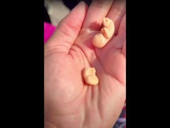 This YouTube screen shot shows plastic models of preborn babies after they had been spat out by a pro-abortion protester.