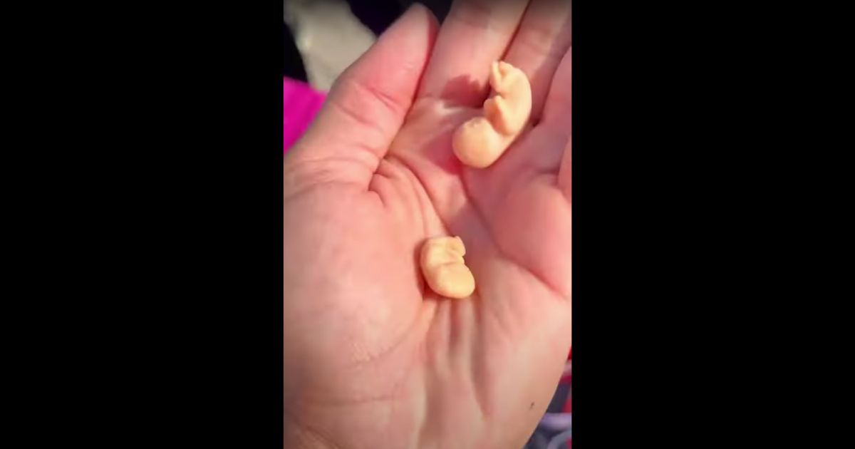 This YouTube screen shot shows plastic models of preborn babies after they had been spat out by a pro-abortion protester.